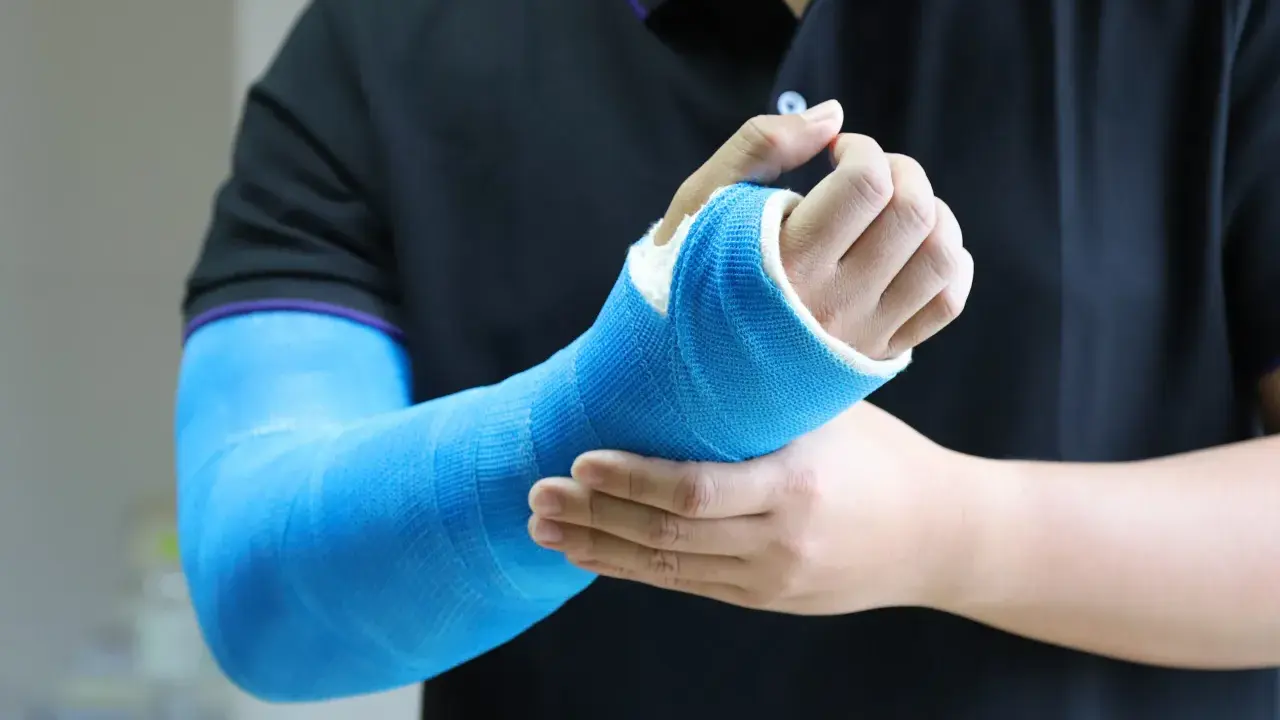 Osoba w czarnej koszulce z fioletowym obszyciem dotyka ręki w niebieskim gipsie, odczuwając dyskomfort związany z odparzeniami pod gipsem.
