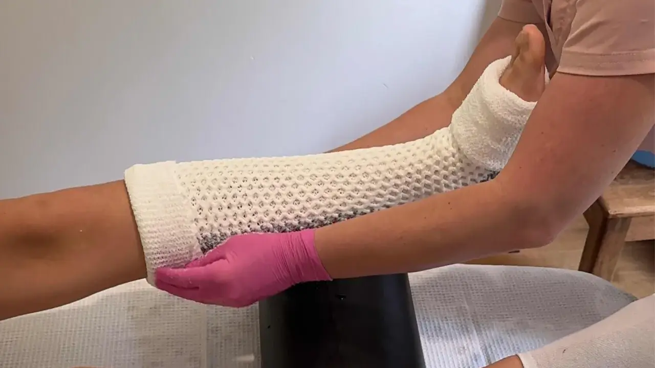 Nakładanie gipsowego opatrunku na nogę. Czy to gips do wody, czy wodą do gipsu? Dłoń w różowej rękawiczce modeluje materiał.