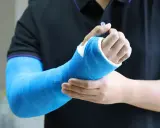 Osoba w czarnej koszulce z fioletowym obszyciem dotyka ręki w niebieskim gipsie, odczuwając dyskomfort związany z odparzeniami pod gipsem.