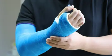 Osoba w czarnej koszulce z fioletowym obszyciem dotyka ręki w niebieskim gipsie, odczuwając dyskomfort związany z odparzeniami pod gipsem.