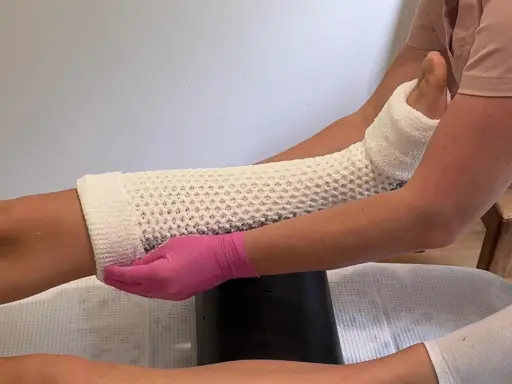 Nakładanie gipsowego opatrunku na nogę. Czy to gips do wody, czy wodą do gipsu? Dłoń w różowej rękawiczce modeluje materiał.