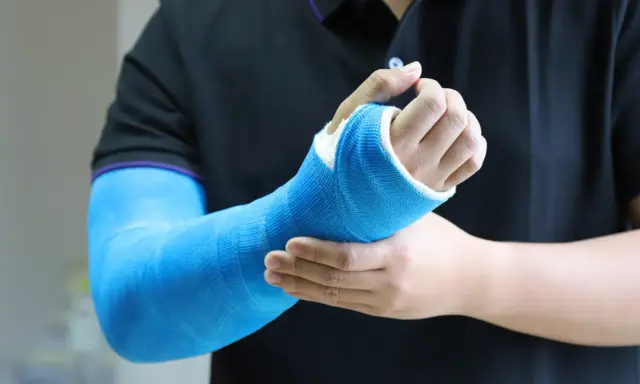 Osoba w czarnej koszulce z fioletowym obszyciem dotyka ręki w niebieskim gipsie, odczuwając dyskomfort związany z odparzeniami pod gipsem.